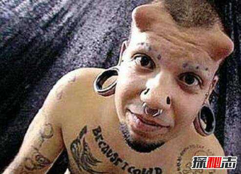 埃里克·斯普拉格,整容不是为了变美?